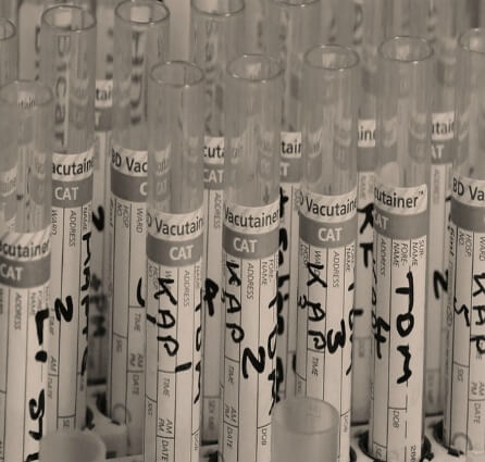 Falsifying Drug Tests and Saliva Testing